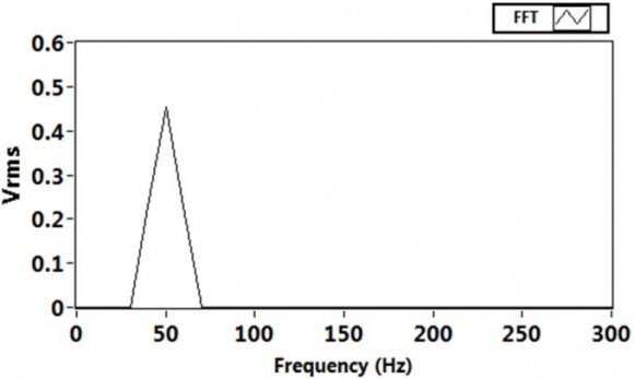 Figure 5 : The results of filtering power supply harmonic 50 Hz. a)Original ECG signal; b) Contaminated ECG signal(noise's magnitude is 0.4 mV); c) recovered ECG signal using proposed Algorithm; d)recovered ECG signal using MLS Algorithm; e) recovered ECG signal using NLMS Algorithm